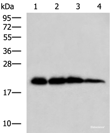 Western blot analysis of Rat brain tissue Hela HepG2 and A172 cell lysates  using HPCAL1 Polyclonal Antibody at dilution of 1:1000