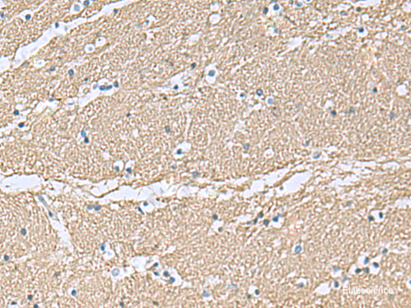 Immunohistochemistry of paraffin-embedded Human brain tissue  using TAGLN3 Polyclonal Antibody at dilution of 1:70(×200)