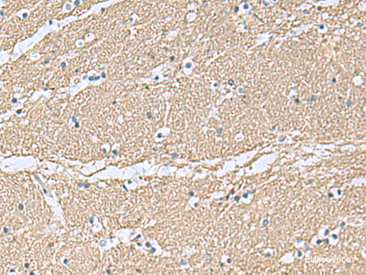 Immunohistochemistry of paraffin-embedded Human brain tissue  using TAGLN3 Polyclonal Antibody at dilution of 1:70(×200)