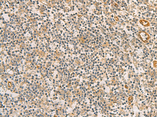 Immunohistochemistry of paraffin-embedded Human tonsil tissue  using RAB13 Polyclonal Antibody at dilution of 1:50(×200)