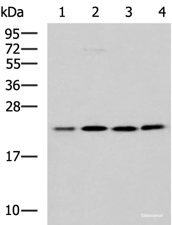 Western blot analysis of K562 A172 Jurkat LOVO cell lysates  using MRPL40 Polyclonal Antibody at dilution of 1:1000