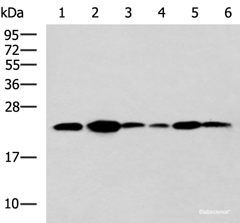 Western blot analysis of NIH/3T3 cell Mouse Pancreas tissue Rat lung tissue Mouse liver tissue Hela Raji cell lysates  using TMED10 Polyclonal Antibody at dilution of 1:900