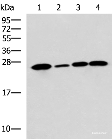 Western blot analysis of Human cerebrum tissue A172 cell Mouse brain tissue Rat brain tissue lysates  using UCHL1 Polyclonal Antibody at dilution of 1:900