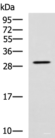 Western blot analysis of SP20 cell lysate  using LRAT Polyclonal Antibody at dilution of 1:800