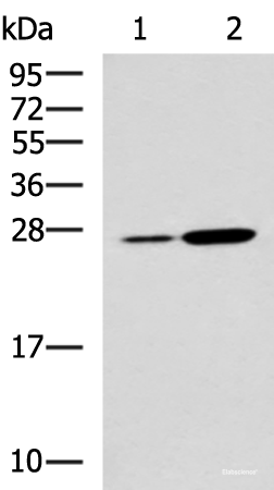 Western blot analysis of Mouse kidney tissue and Mouse liver tissue lysates  using NQO2 Polyclonal Antibody at dilution of 1:1000