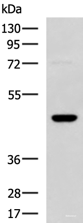 Western blot analysis of TM4 cell lysate  using DNAJA4 Polyclonal Antibody at dilution of 1:800