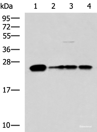 Western blot analysis of 293T LO2 and HepG2 cell lysates  using MMAB Polyclonal Antibody at dilution of 1:1400