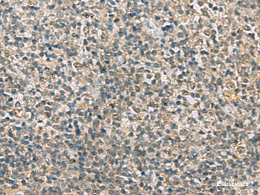Immunohistochemistry of paraffin-embedded Human tonsil tissue  using RAB3IP Polyclonal Antibody at dilution of 1:60(×200)