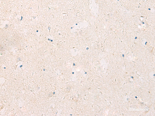 Immunohistochemistry of paraffin-embedded Human brain tissue  using KCNIP3 Polyclonal Antibody at dilution of 1:90(×200)