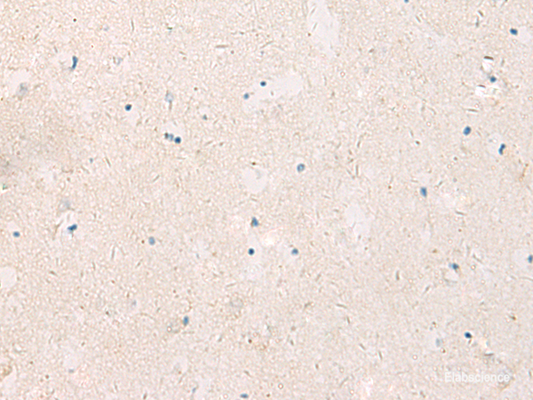 Immunohistochemistry of paraffin-embedded Human brain tissue  using KCNIP3 Polyclonal Antibody at dilution of 1:90(×200)