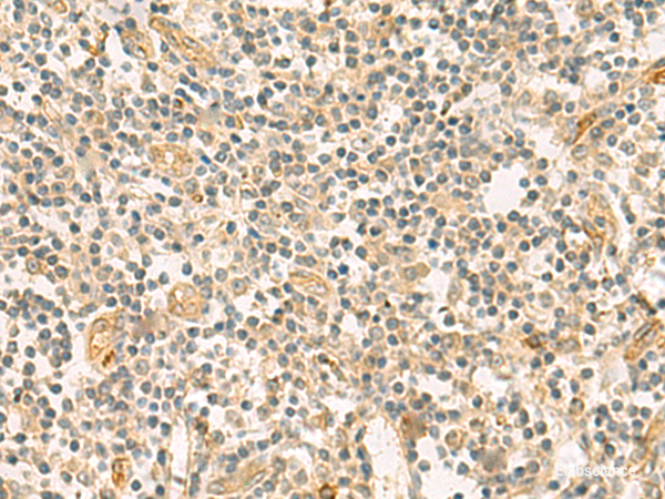 Immunohistochemistry of paraffin-embedded Human tonsil tissue  using HHIPL2 Polyclonal Antibody at dilution of 1:55(×200)