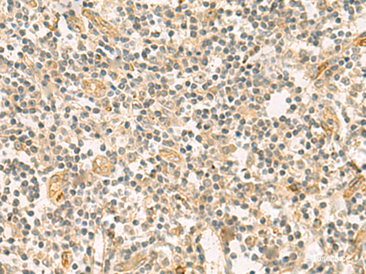 Immunohistochemistry of paraffin-embedded Human tonsil tissue  using HHIPL2 Polyclonal Antibody at dilution of 1:55(×200)