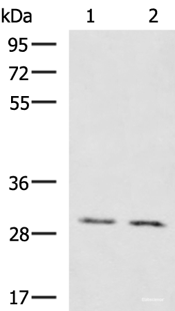 Western blot analysis of Mouse brain tissue Mouse kidney tissue lysates  using KRCC1 Polyclonal Antibody at dilution of 1:1350