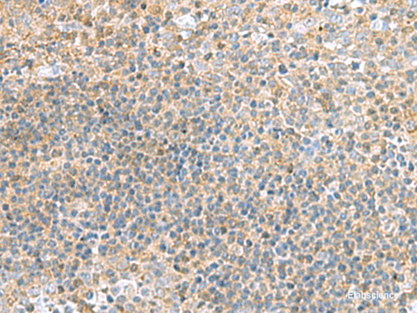 Immunohistochemistry of paraffin-embedded Human tonsil tissue  using TSTA3 Polyclonal Antibody at dilution of 1:45(×200)