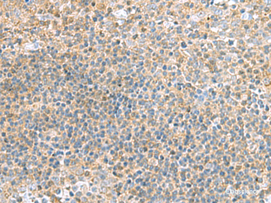 Immunohistochemistry of paraffin-embedded Human tonsil tissue  using TSTA3 Polyclonal Antibody at dilution of 1:45(×200)