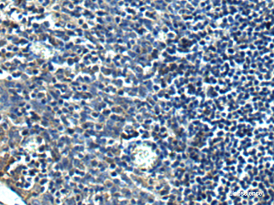 Immunohistochemistry of paraffin-embedded Human tonsil tissue  using PRRT2 Polyclonal Antibody at dilution of 1:40(×200)