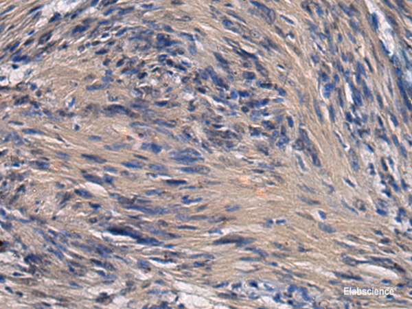 Immunohistochemistry of paraffin-embedded Human brain tissue  using ICA1 Polyclonal Antibody at dilution of 1:70(×200)