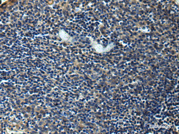 Immunohistochemistry of paraffin-embedded Human tonsil tissue  using ERLIN1 Polyclonal Antibody at dilution of 1:50(×200)