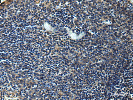 Immunohistochemistry of paraffin-embedded Human tonsil tissue  using ERLIN1 Polyclonal Antibody at dilution of 1:50(×200)