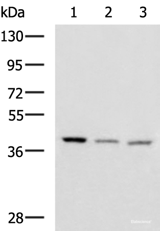 Western blot analysis of Human cerebrum tissue Human cerebella tissue Mouse brain tissue lysates  using ENKD1 Polyclonal Antibody at dilution of 1:1150