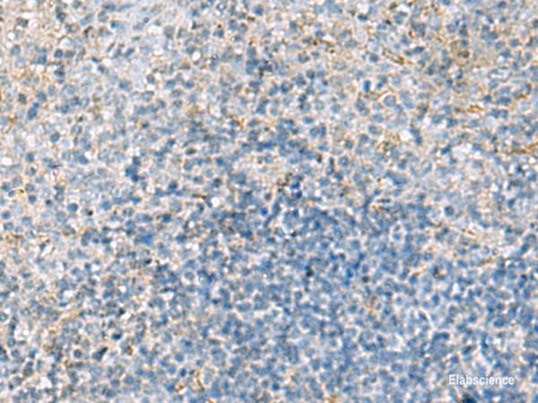 Immunohistochemistry of paraffin-embedded Human tonsil tissue  using EMILIN1 Polyclonal Antibody at dilution of 1:70(×200)