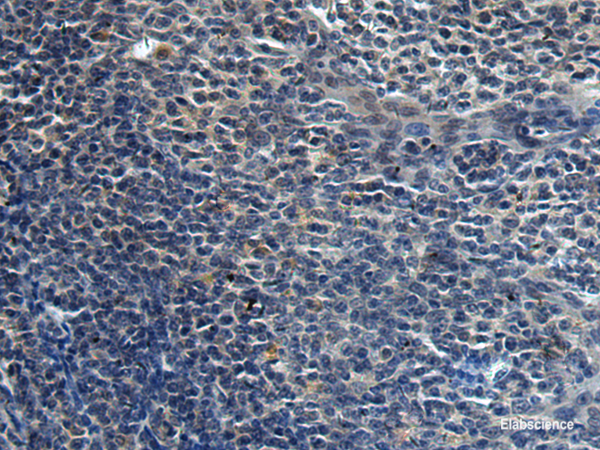 Immunohistochemistry of paraffin-embedded Human tonsil tissue  using HAUS6 Polyclonal Antibody at dilution of 1:45(×200)