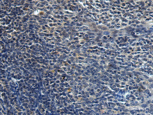 Immunohistochemistry of paraffin-embedded Human tonsil tissue  using HAUS6 Polyclonal Antibody at dilution of 1:45(×200)