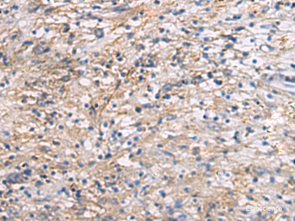 Immunohistochemistry of paraffin-embedded Human brain tissue  using CEP89 Polyclonal Antibody at dilution of 1:95(×200)