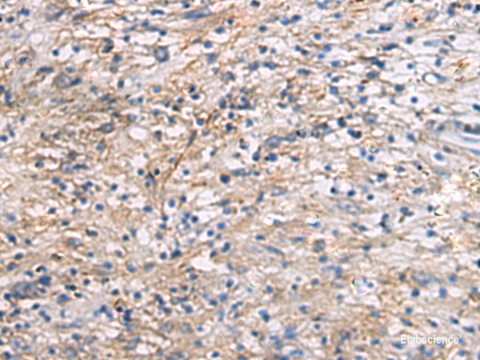 Immunohistochemistry of paraffin-embedded Human brain tissue  using CEP89 Polyclonal Antibody at dilution of 1:95(×200)