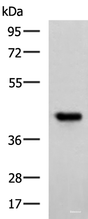 Western blot analysis of Ramos cell lysate  using FCRLA Polyclonal Antibody at dilution of 1:750