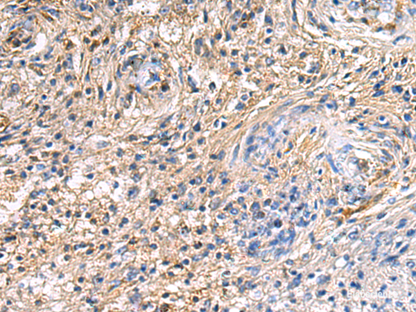 Immunohistochemistry of paraffin-embedded Human brain tissue  using SAV1 Polyclonal Antibody at dilution of 1:90(×200)