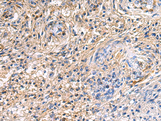 Immunohistochemistry of paraffin-embedded Human brain tissue  using SAV1 Polyclonal Antibody at dilution of 1:90(×200)