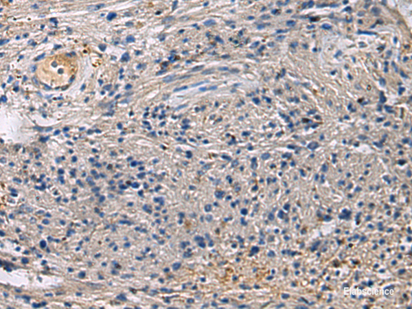 Immunohistochemistry of paraffin-embedded Human brain tissue  using SLC30A3 Polyclonal Antibody at dilution of 1:55(×200)