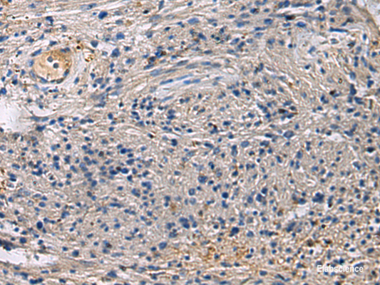 Immunohistochemistry of paraffin-embedded Human brain tissue  using SLC30A3 Polyclonal Antibody at dilution of 1:55(×200)