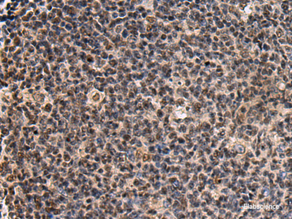 Immunohistochemistry of paraffin-embedded Human tonsil tissue  using SIK3 Polyclonal Antibody at dilution of 1:60(×200)