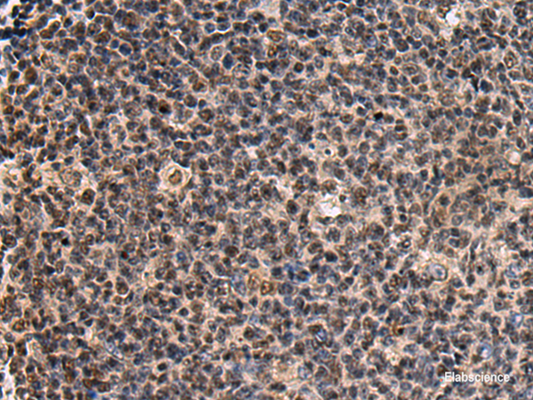 Immunohistochemistry of paraffin-embedded Human tonsil tissue  using SIK3 Polyclonal Antibody at dilution of 1:60(×200)
