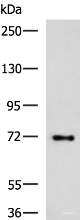 Western blot analysis of HepG2 cell lysate  using TTLL10 Polyclonal Antibody at dilution of 1:850