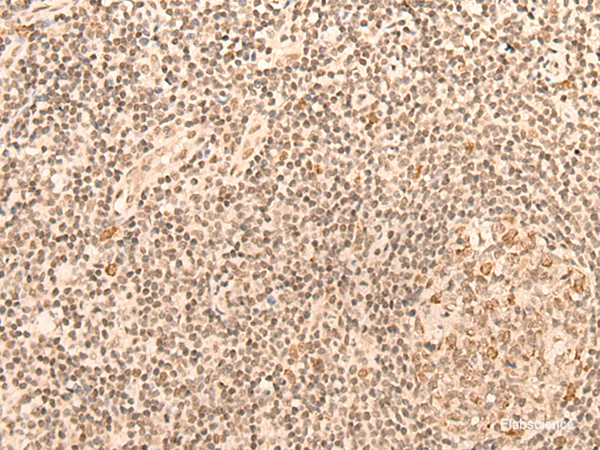Immunohistochemistry of paraffin-embedded Human tonsil tissue  using CCNE1 Polyclonal Antibody at dilution of 1:25(×200)