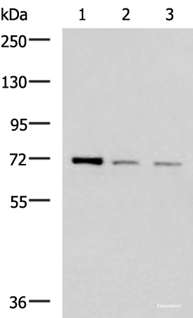 Western blot analysis of K562 HepG2 and Jurkat cell lysates  using FOXK1 Polyclonal Antibody at dilution of 1:400