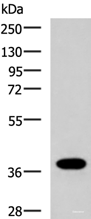 Western blot analysis of Human placenta tissue lysate  using GPR6  Polyclonal Antibody at dilution of 1:1000