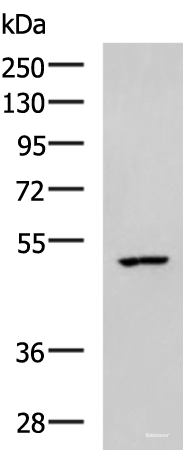 Western blot analysis of MCF7 cell lysate  using CKMT1A/CKMT1B Polyclonal Antibody at dilution of 1:600