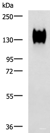 Western blot analysis of A549 cell lysate  using CEACAM1 Polyclonal Antibody at dilution of 1:500