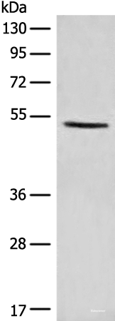 Western blot analysis of NIH/3T3 cell lysate  using PTEN Polyclonal Antibody at dilution of 1:1100