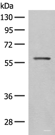 Western blot analysis of Mouse eye tissue lysate  using SLC5A1 Polyclonal Antibody at dilution of 1:500