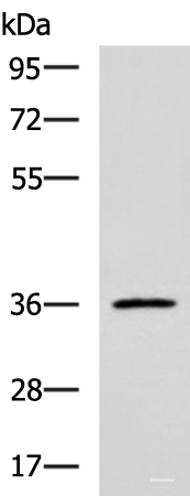 Western blot analysis of Jurkat cell lysate  using IBSP Polyclonal Antibody at dilution of 1:700