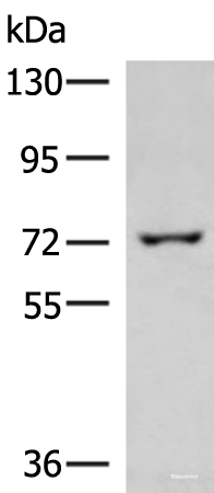 Western blot analysis of 293T cell lysate  using GLS Polyclonal Antibody at dilution of 1:850