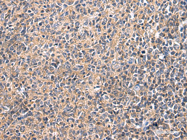 Immunohistochemistry of paraffin-embedded Human tonsil tissue  using UBTD1 Polyclonal Antibody at dilution of 1:25(×200)