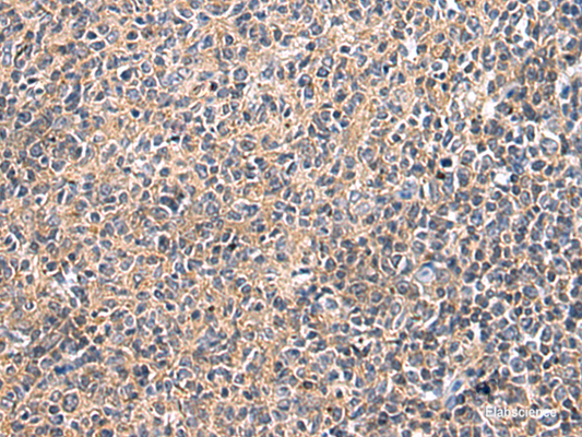 Immunohistochemistry of paraffin-embedded Human tonsil tissue  using UBTD1 Polyclonal Antibody at dilution of 1:25(×200)