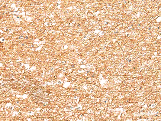 Immunohistochemistry of paraffin-embedded Human brain tissue  using ZNF185 Polyclonal Antibody at dilution of 1:25(×200)