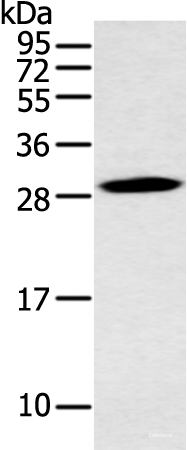 Western blot analysis of Mouse stomach tissue  using YRDC Polyclonal Antibody at dilution of 1:400